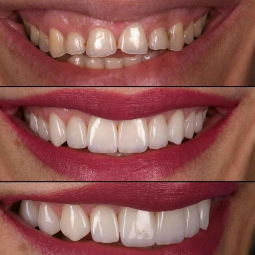 carrusel 02 512x512px