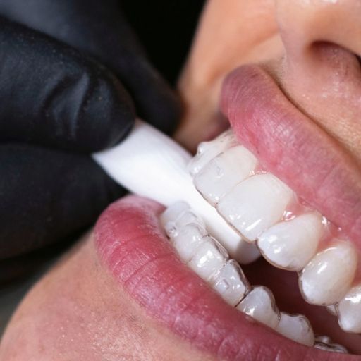 La importancia de las revisiones odontológicas periódicas para una salud integral